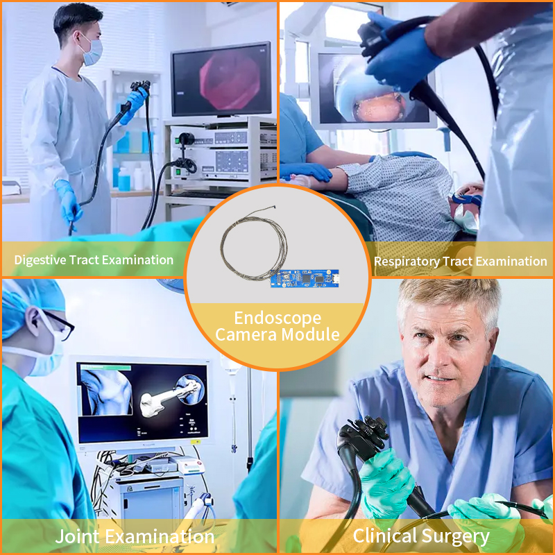 Side - View and USB Interface: An Analysis of Practical Application Advantages of Endoscope Camera Module