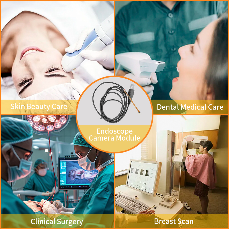 Essential Conditions for Disposable Medical Endoscope Camera Module